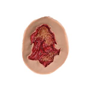 Laerdal Medical-Deep Abrasion - Laerdal-MedTech-2